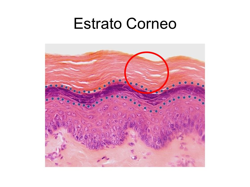 absolutamente córneo absolutamente córneo